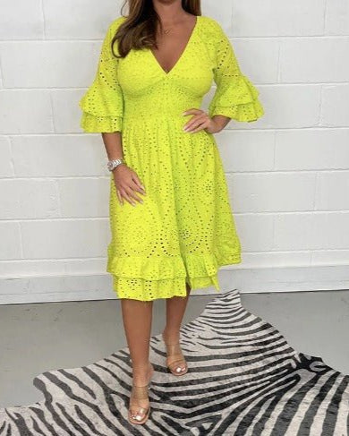 Alba™ | Casual Lace Dress